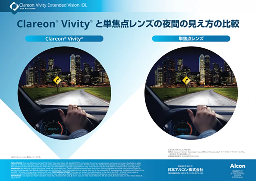 Clareon Vivityと単焦点レンズの夜間の見え方の比較