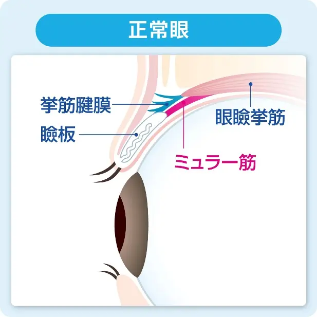 正常眼